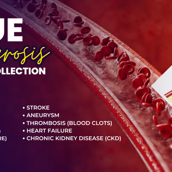 Plaque Buildup / Atherosclerosis